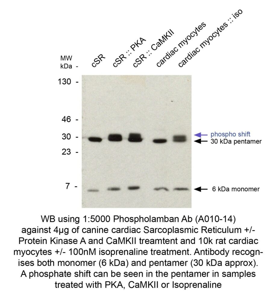 PHOSPHOLAMBAN PLN PLB MAB CLONE A1 Badrilla