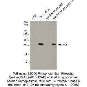 phospholamban pab plb