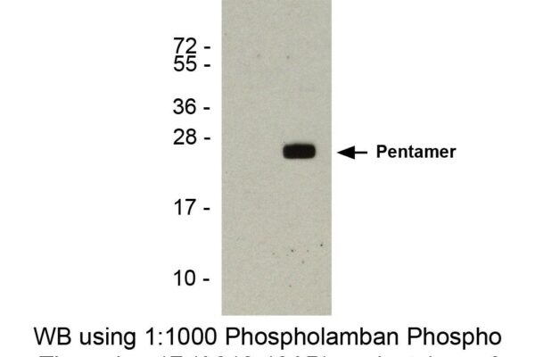 phospholamban pab csr