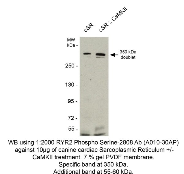 ryanodine receptor 2