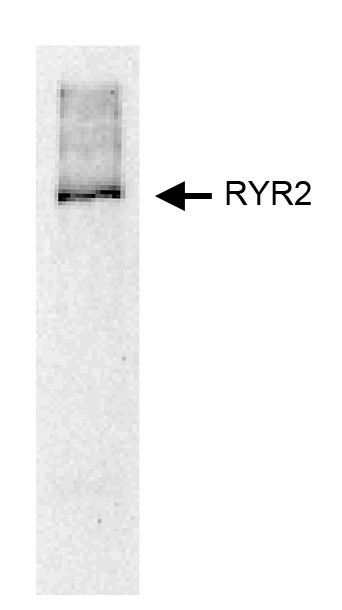 ryanodine receptor 2