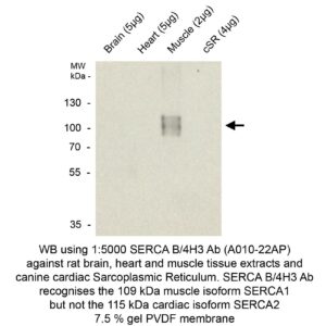 serca1 mab clone
