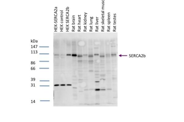 serca2b pab serum1